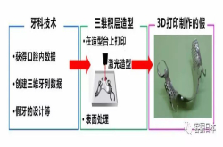 日本3D打印假牙投入实用