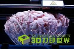 放眼看世界：盘点全球3D打印技术在癌症诊断与治疗中的应用情况