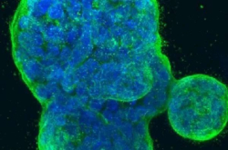 JNCI：神奇的纳米颗粒或能改善乳腺癌患者的化疗反应
