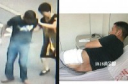 小米手机放裤袋爆炸浙江男臀部烧伤