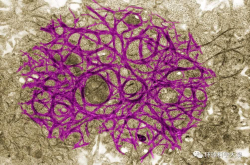 科学家发现史上最古老头皮屑 距今1.25亿年 揭开古生物进化之谜