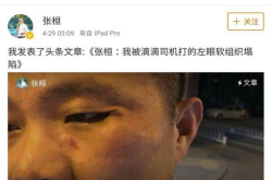 滴滴回应投资人张恒快车冲突事件：垫付药费、配合调查