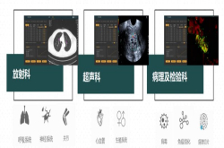 复星集团再次押注医疗AI 孵化AI辅助诊断平台杏脉科技