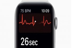 Apple Watch心电图功能真的能救命, 可惜现在只有美国能用
