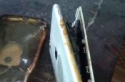 烧出水泡！开封某男子的iPhone放裤兜爆炸