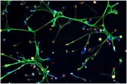 Science：鉴定出一种导致休眠的癌细胞重新唤醒和转移的新途径