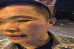 被打滴滴投资人再发声：未让滴滴垫医疗费