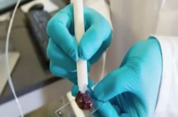 准确率高达96.5％的3D打印测癌笔 十秒内可出结果