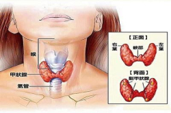 甲状腺 不可不知的那些事儿