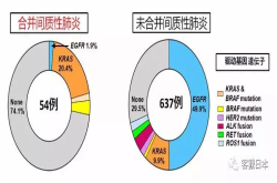 日本发现间质性肺炎合并肺腺癌会产生特征性基因突变