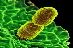 可以来了解下？CRE感染：病因、症状、治疗及预防