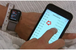 AppleWatch真的能救命 24岁小伙发现心脏先天漏洞