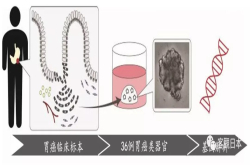 日本查明胃癌细胞繁殖机理 有望推出胃癌新疗法
