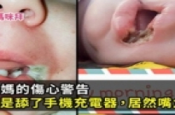 一位妈妈的痛心教训:小孩只是舔了手机充电器,居然嘴角溃烂!