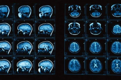 突破：研究人员用3D打印技术打印出了最精确的大脑模型
