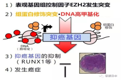 日本多所大学利用小鼠成功再现早期前体T细胞急性淋巴白血病